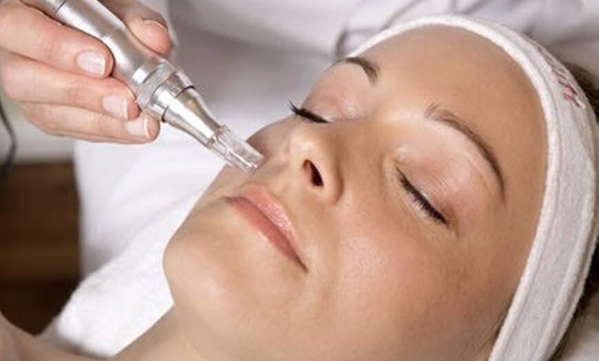 Nano Needling Facial